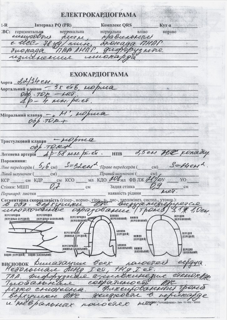 DrogMedia Дрогобичанину Дмитрові Кондуру (1984 р.н.) потрібна трансплантація серця!
