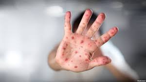 DrogMedia Кір не стихає: географія недуги