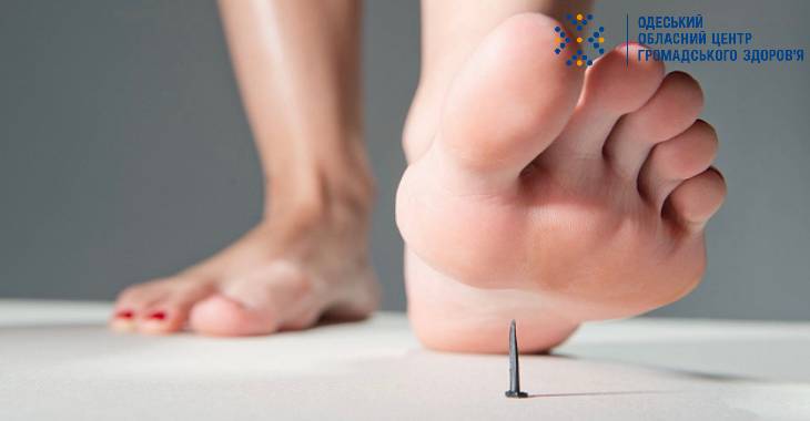 DrogMedia Правець: симптоми можуть з’явитися протягом 3–21 дня після зараження