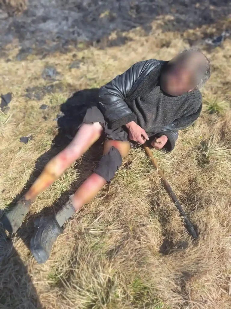 За добу через підпали сухостою померли троє людей, серед них житель Дрогобиччини 2 DrogMedia За добу через підпали сухостою померли троє людей, серед них житель Дрогобиччини