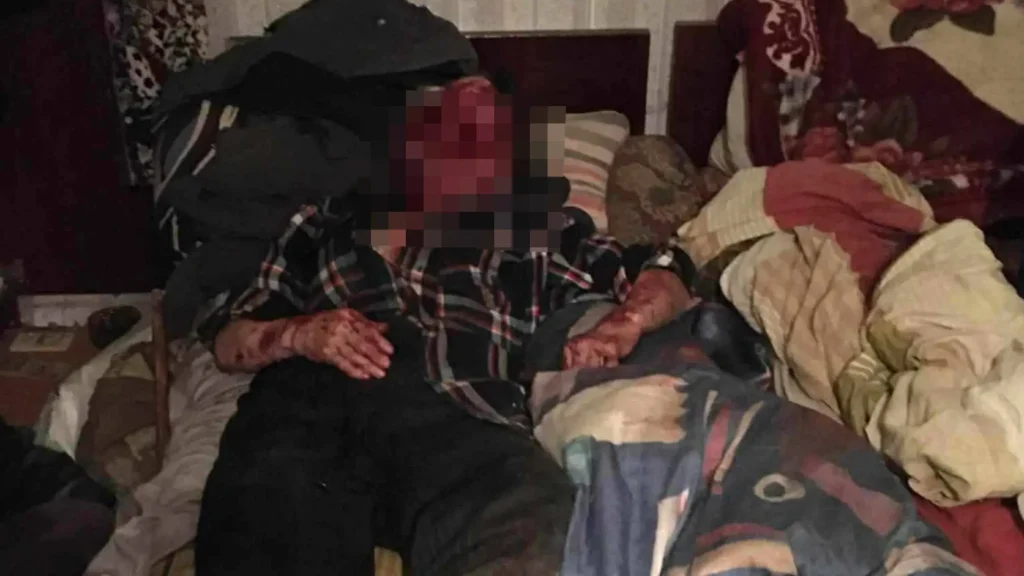 DrogMedia На Дрогобиччині жінка жорстоко побила 81-річного батька кочергою: чоловік у реанімації